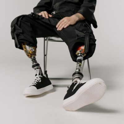 Stylish prosthetic legs with black sneakers captured in a modern studio setting.
